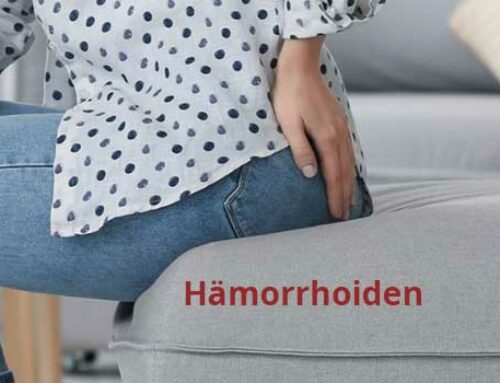 Hämorrhoiden: Natürliche Heilmittel mit Kräutern